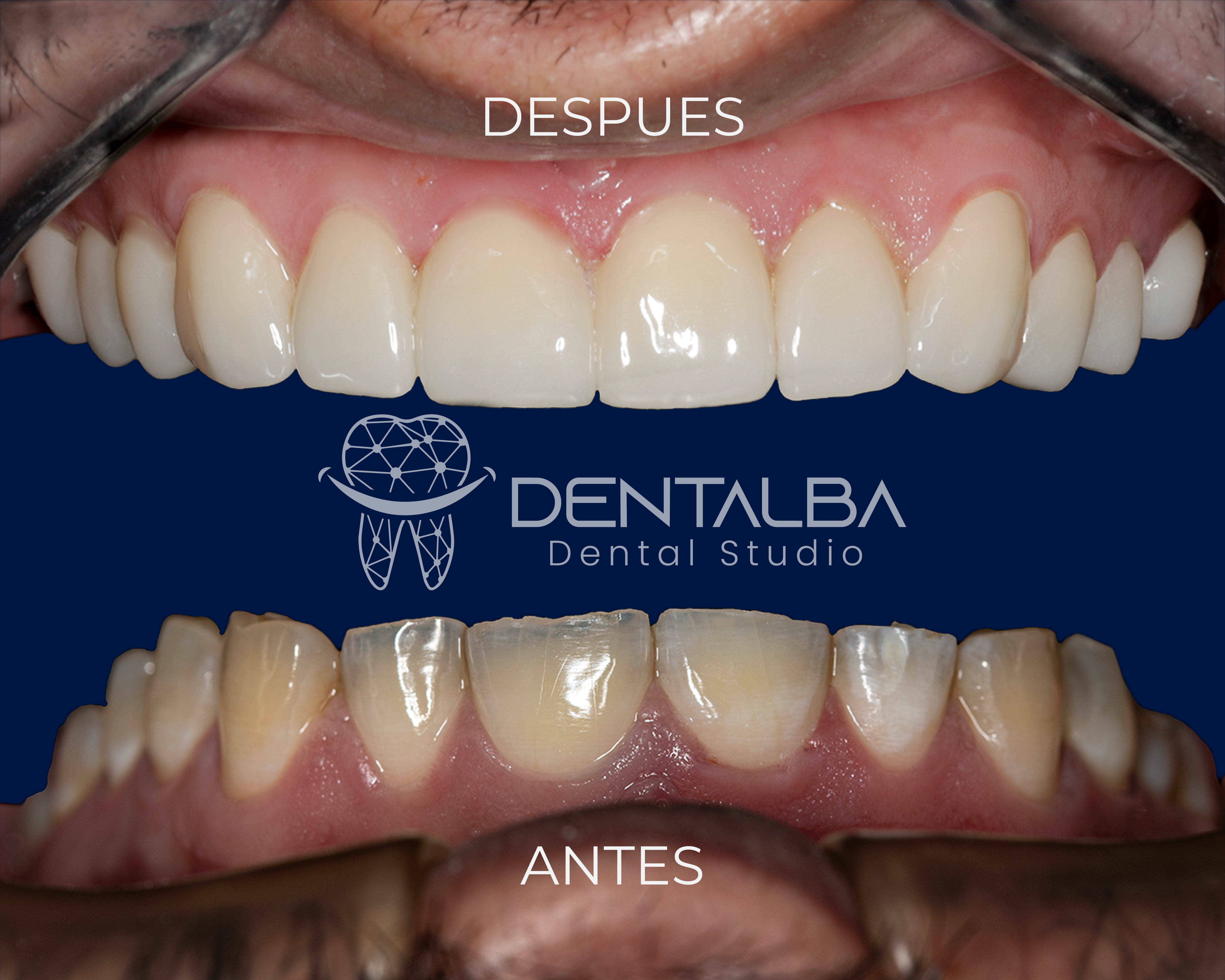 Endodoncia